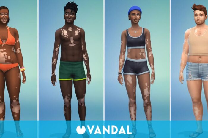 Lles Sims 4 refuerza su inclusividad introduciendo la piel de vitiligo